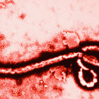 Ebola Awareness Part 1: History and Facts